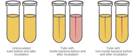 use of test tube with soft agar|Basic Bacterial Culturing Practices .